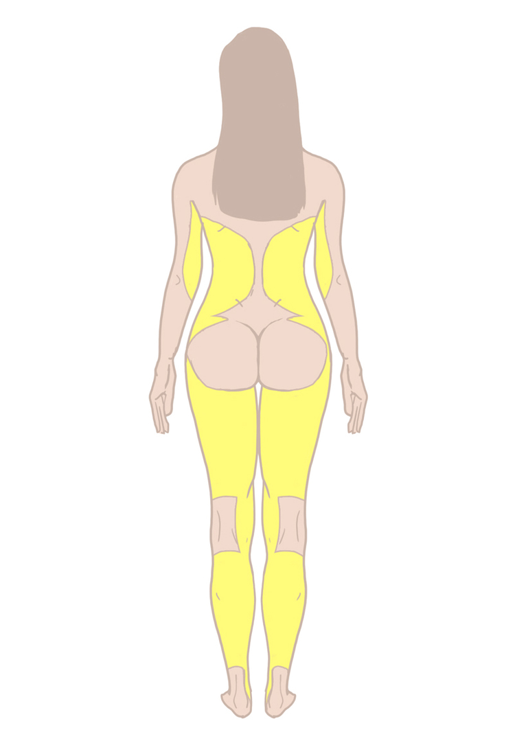 Common Areas of Liposuction in the Back