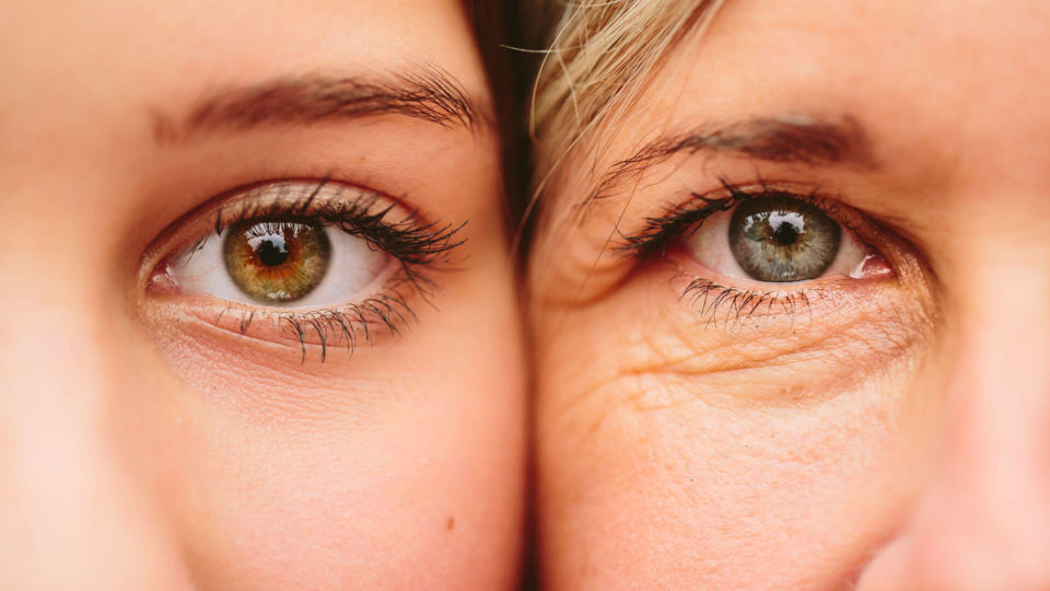 Lower Eyelid Surgery New York City banner