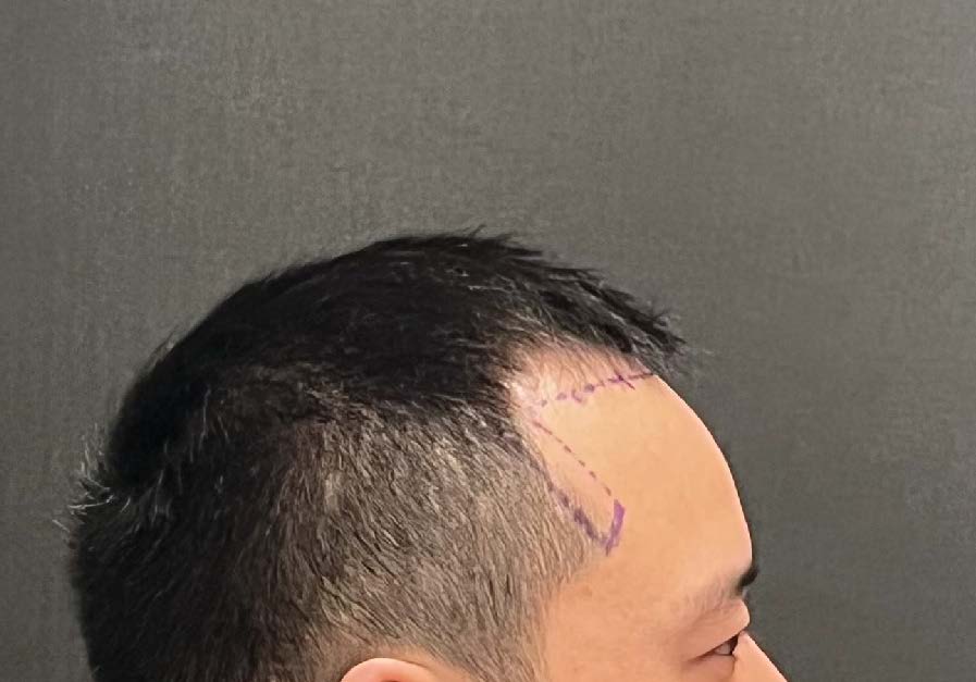27432-46210