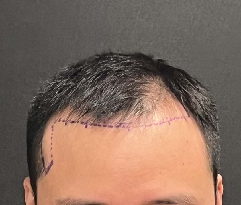 27432-85590